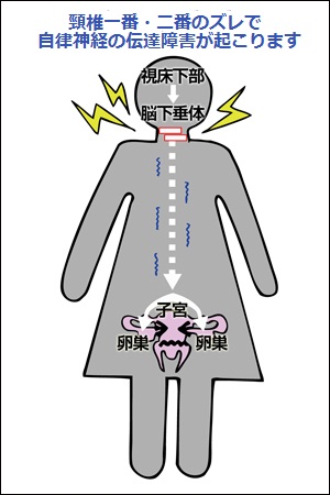 伝達障害