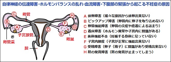 不妊症の原因